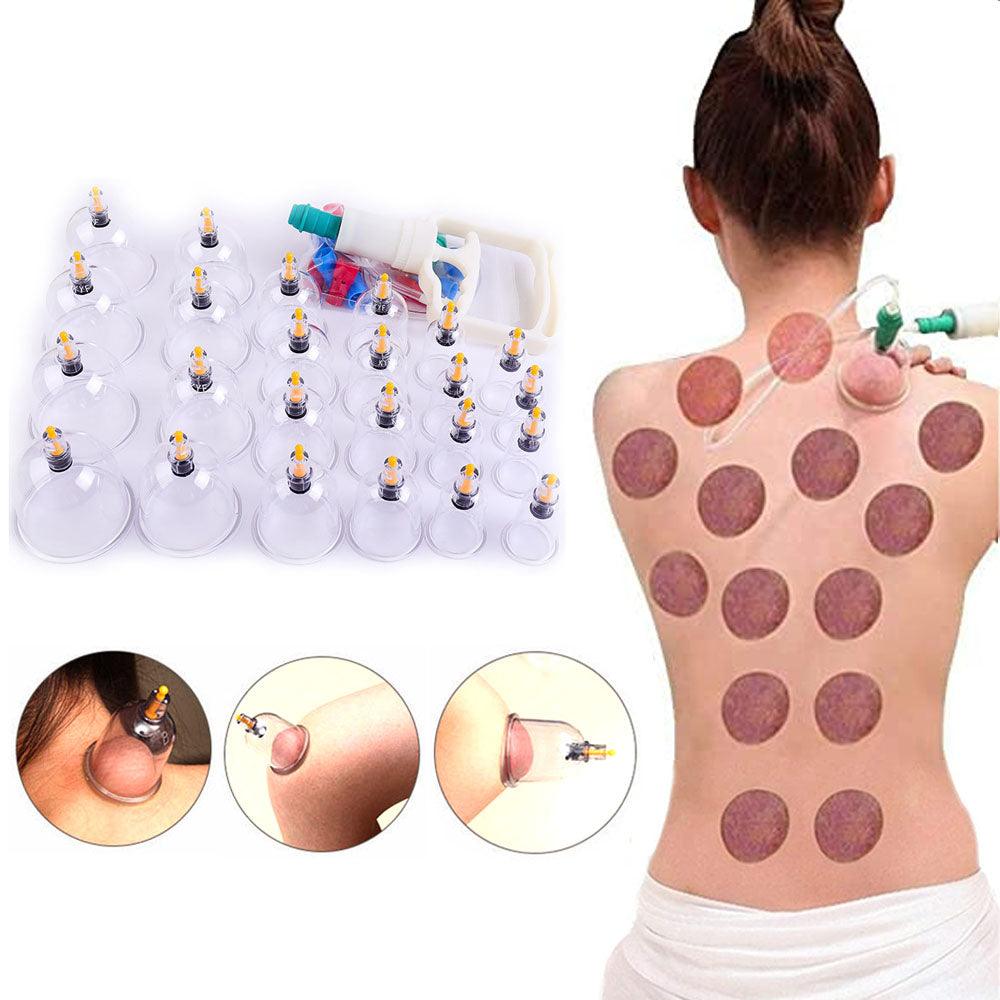 Set Terapia CUPPING Ventosas Chinas Comfort – Confort Orthopédique