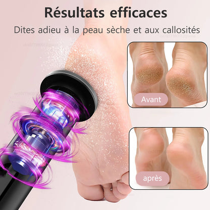 Râpe à pied électrique - Outil rechargeable pour éliminer les callosités - Image 5