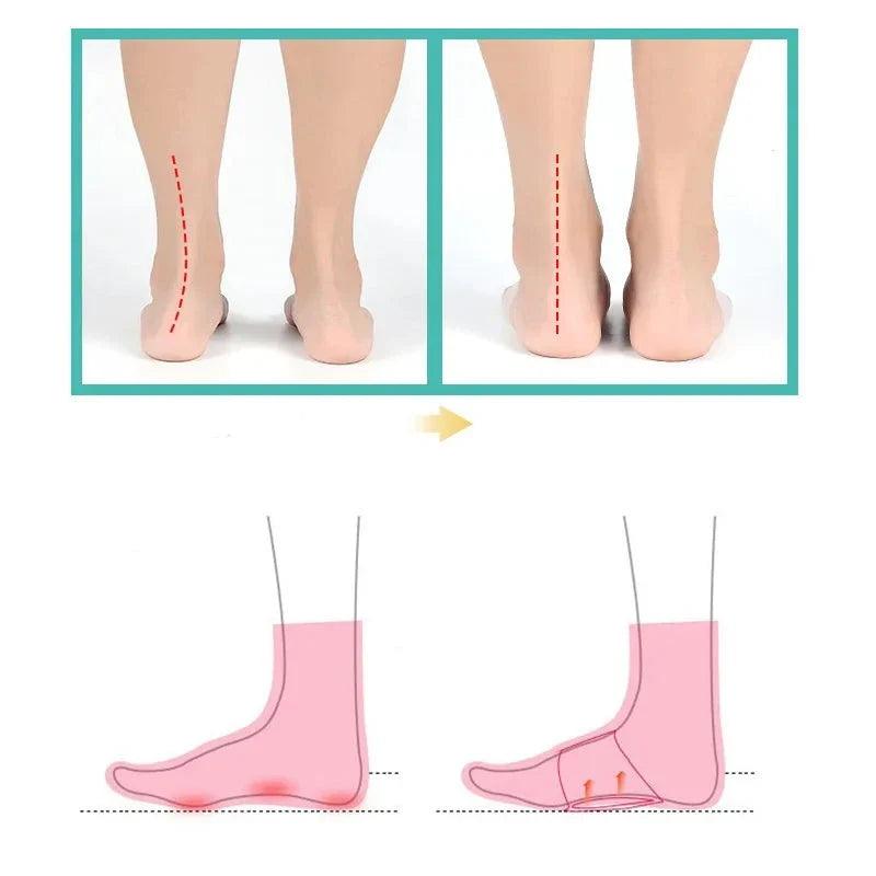 Orthese plantaire Sol Confort - Confort Orthopédique