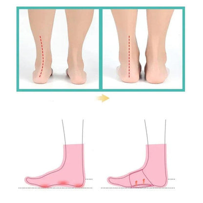Orthese plantaire Sol Confort - Confort Orthopédique
