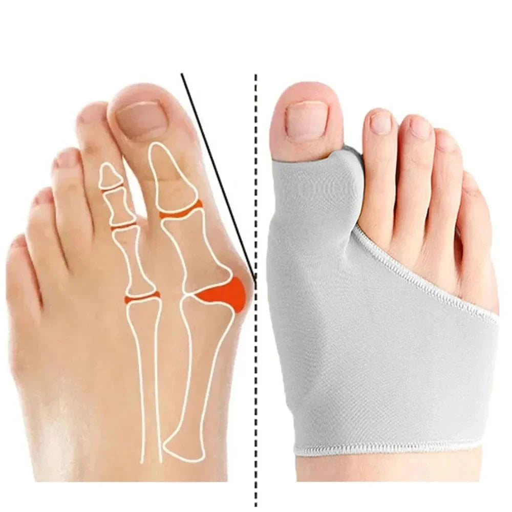 Chaussette Orthopédique Femme pour le Traitement d’Hallux Valgus - Gris