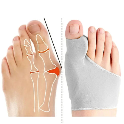 Chaussette Orthopédique Femme pour le Traitement d’Hallux Valgus - Gris