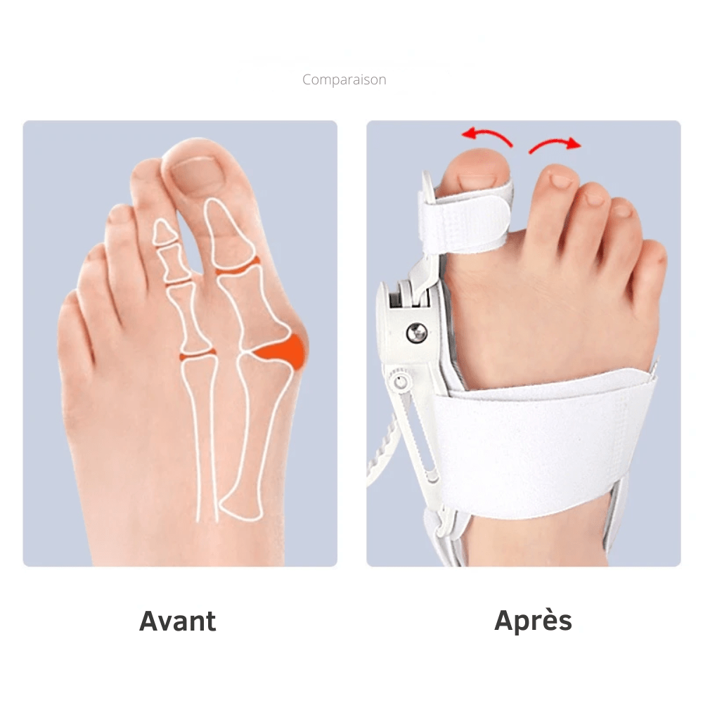 Chaussette Orthopédique Homme Ajusteur Pouce de Pied - Bleu