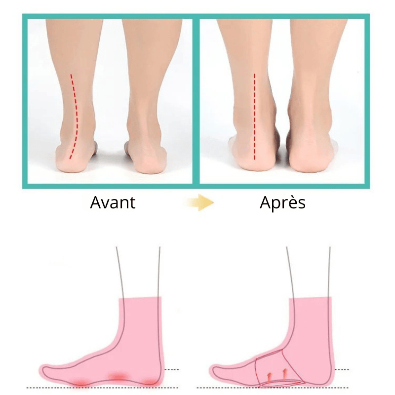 Lot De 4 Pièces Orthopédiques En Silicone Pour Pieds Plats - Image 4