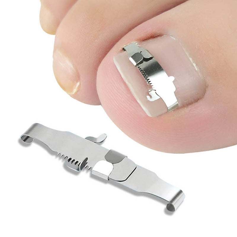 stainless steel ingrown toenail corrector