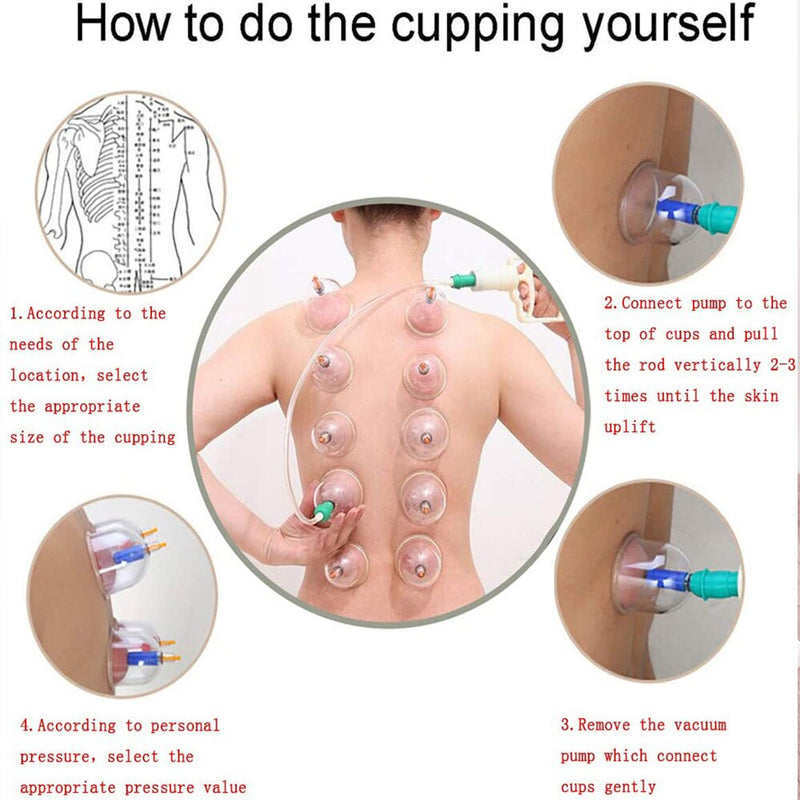 CUPPING Therapy Set Chinese Cupping Cups