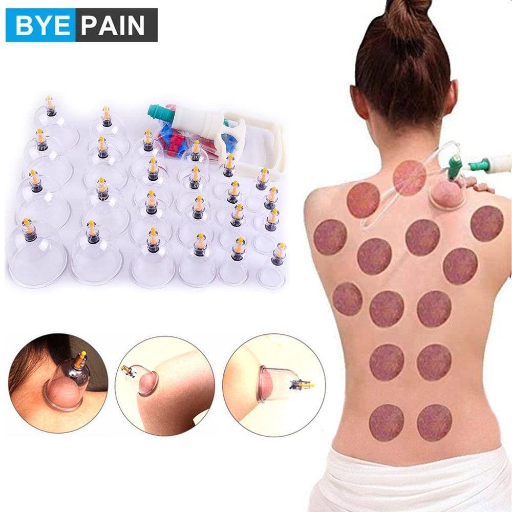 Set Terapia CUPPING Ventosas Chinas Comfort – Confort Orthopédique